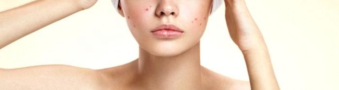 Acne & Blemish Treatments